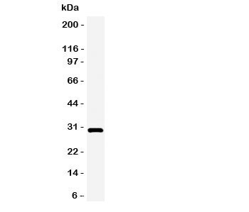 Adiponectin Antibody - Western blot testing of Adiponectin antibody and rat heart tissue lysate. Expected/observed size ~30KD