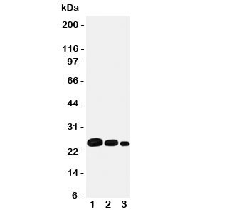 Adiponectin Antibody - Western blot testing of Adiponectin antibody and recombinant protein; Lane 1: 10ng; 2: 5ng; 3: 2.5ng