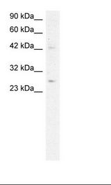 Adiponectin Antibody - Jurkat Cell Lysate.  This image was taken for the unconjugated form of this product. Other forms have not been tested.