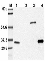 Adiponectin Antibody - Western blot analysis using anti-Adiponectin (mouse), mAb (MADI 04) at 1:5000 dilution. 1: Mouse serum. 2: Human serum. 3: Mouse adiponectin Fc-fusion protein. 4: Recombinant mouse adiponectin (His-tagged).