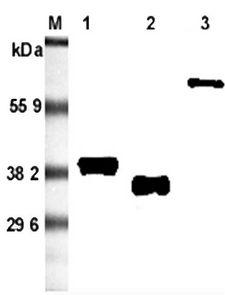 Adiponectin Antibody - Western blot analysis using anti-Adiponectin (rat), mAb (RADI 264) at 1:5000 dilution. 1: Rat adiponectin (FLAG-tagged ). 2: Recombinant rat adiponectin (His-tagged). 3: Rat adiponectin Fc-fusion protein.
