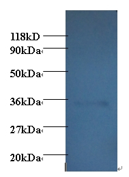 Adiponectin Antibody - Western blot of Adiponectin antibody at 2 ug/ml + EC109 whole cell lysate at 20 ug. Secondary: Goat polyclonal to Rabbit IgG at 1:15000 dilution. Predicted band size:27 kDa. Observed band size: 35 kDa.  This image was taken for the unconjugated form of this product. Other forms have not been tested.
