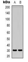 Adiponectin Antibody - Western blot analysis of Adiponectin expression in HeLa (A); HEK293T (B) whole cell lysates.