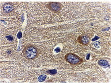 Adiponectin Antibody - Immunohistochemistry of adiponectin in rat brain tissue with adiponectin antibody at 1 ug/ml.