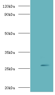 Adiponectin Antibody - Western blot of Adiponectin antibody at 2 ug/ml with recombinant Adiponectin protein 0.1 ug Secondary.