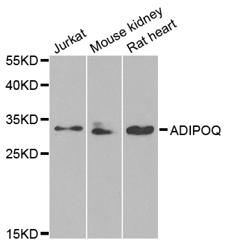 Adiponectin Antibody - Western blot analysis of extracts of various cell lines.