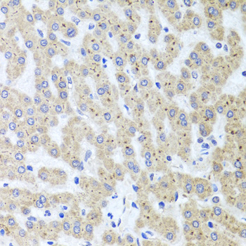 Adiponectin Antibody - Immunohistochemistry of paraffin-embedded human liver injury tissue.