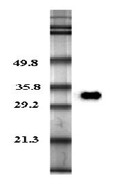 Adiponectin Antibody - Western blot analysis in human plasma using anti-Adiponectin (human), pAb at 0.2 ug/ml concentration.  This image was taken for the unconjugated form of this product. Other forms have not been tested.