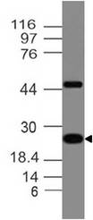 Adiponectin Antibody - Fig-1: Expression analysis of Adiponectin. Anti-Adiponectin antibody was tested at 2 µg/ml on h Kidney lysate.