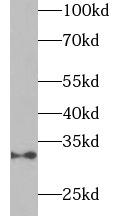 Adiponectin Antibody - Jurkat cells were subjected to SDS PAGE followed by western blot with anti-ADIPOQ antibody at dilution of 1:1000