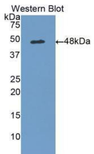 ADIPOR1/Adiponectin Receptor 1 Antibody - Western blot of recombinant ADIPOR1/Adiponectin Receptor 1.  This image was taken for the unconjugated form of this product. Other forms have not been tested.