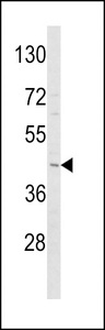 ADIPOR1/Adiponectin Receptor 1 Antibody - Western blot of ADIPOR1 Antibody in Y79 cell line lysates (35 ug/lane). ADIPOR1 (arrow) was detected using the purified antibody.