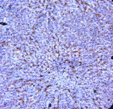 ADIPOR1/Adiponectin Receptor 1 Antibody - IHC of ADIPOR1 / Adiponectin Receptor antibody. Formalin-fixed, paraffin-embedded human liver.