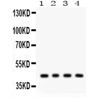 ADIPOR1/Adiponectin Receptor 1 Antibody - ADIPOR1 antibody Western blot. All lanes: Anti ADIPOR1 at 0.5 ug/ml. Lane 1: Rat Thymus Tissue Lysate at 50 ug. Lane 2: Rat Testis Tissue Lysate at 50 ug. Lane 3: MCF-7 Whole Cell Lysate at 40 ug. Lane 4: A549 Whole Cell Lysate at 40 ug. Predicted band size: 43 kD. Observed band size: 43 kD.