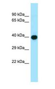 ADIPOR1/Adiponectin Receptor 1 Antibody - ADIPOR1 / Adiponectin Receptor antibody Western Blot of MDA-MB-435S.  This image was taken for the unconjugated form of this product. Other forms have not been tested.
