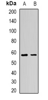 ADIPOR1/Adiponectin Receptor 1 Antibody - Western blot analysis of AdipoR1 expression in BT474 (A); mouse skeletal muscle (B) whole cell lysates.