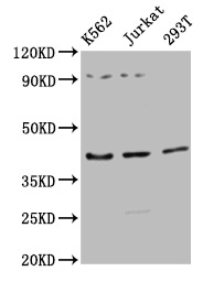 ADIPOR1/Adiponectin Receptor 1 Antibody - Western Blot Positive WB detected in: K562 whole cell lysate, Jurkat whole cell lysate, 293T whole cell lysate All lanes: ADIPOR1 antibody at 1:2500 Secondary Goat polyclonal to rabbit IgG at 1/50000 dilution Predicted band size: 43 kDa Observed band size: 43 kDa