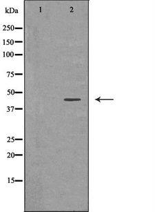 ADIPOR1/Adiponectin Receptor 1 Antibody - Western blot analysis of extracts of Y79 using ADIPOR1 antibody. The lane on the left is treated with the antigen-specific peptide.