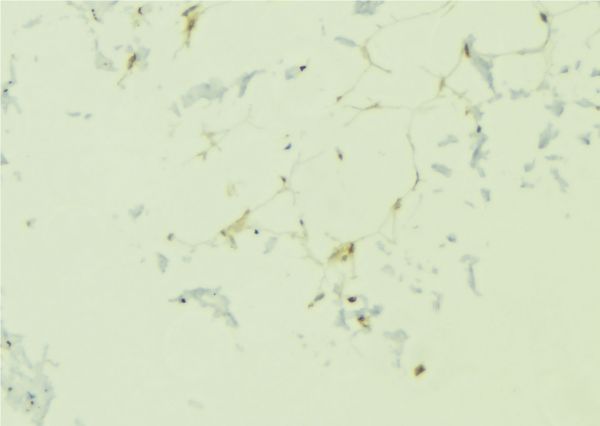ADIPOR1/Adiponectin Receptor 1 Antibody - 1:100 staining human lung tissue by IHC-P. The sample was formaldehyde fixed and a heat mediated antigen retrieval step in citrate buffer was performed. The sample was then blocked and incubated with the antibody for 1.5 hours at 22°C. An HRP conjugated goat anti-rabbit antibody was used as the secondary.
