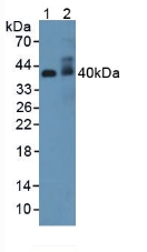 ADIPOR2 Antibody - Western Blot; Sample: Lane1: Rat Serum; Lane2: Rat Uterus Tissue.