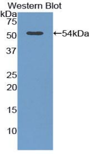 ADIPOR2 Antibody - Western blot of recombinant ADIPOR2.  This image was taken for the unconjugated form of this product. Other forms have not been tested.