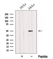 ADIPOR2 Antibody - Western blot analysis of extracts of HeLa cells using ADIPOR2 antibody. The lane on the left was treated with blocking peptide.