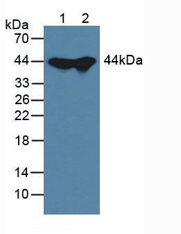 ADK / Adenosine Kinase Antibody - Western Blot; Lane1: Mouse Liver Tissue; Lane2: Mouse Testis Tissue.