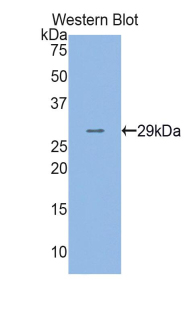 ADK / Adenosine Kinase Antibody - Western blot of recombinant ADK / Adenosine Kinase.  This image was taken for the unconjugated form of this product. Other forms have not been tested.