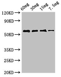 ADK / Adenosine Kinase Antibody - Western Blot Positive WB detected in Recombinant protein All lanes: AK antibody at 2.8µg/ml Secondary Goat polyclonal to rabbit IgG at 1/50000 dilution Predicted band size: 55 kDa Observed band size: 55 kDa