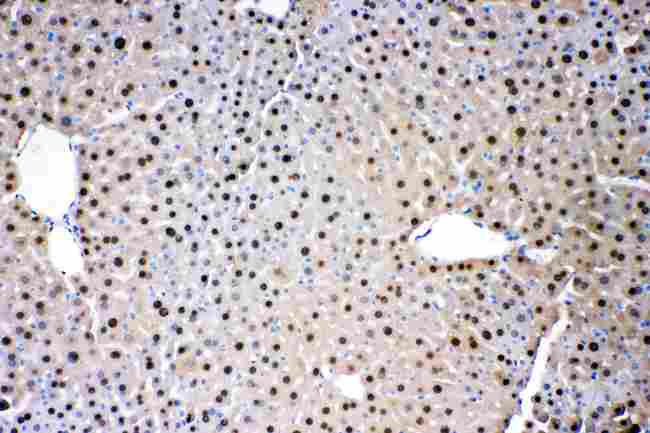 ADK / Adenosine Kinase Antibody - ADK was detected in paraffin-embedded sections of mouse liver tissues using rabbit anti- ADK Antigen Affinity purified polyclonal antibody