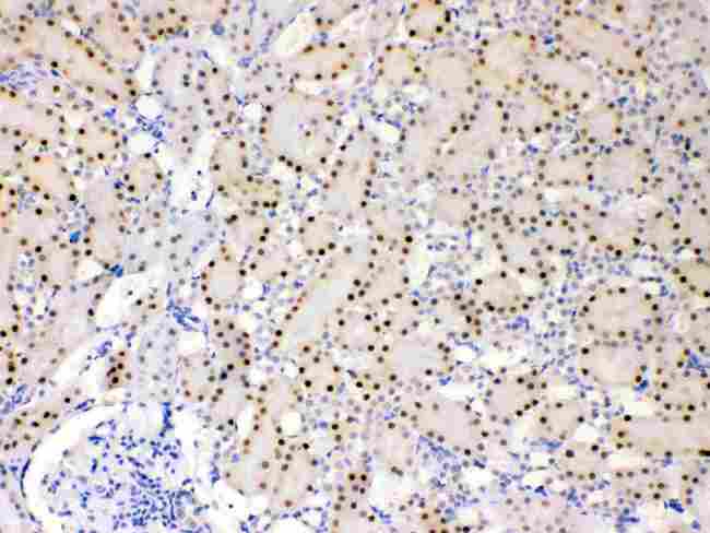 ADK / Adenosine Kinase Antibody - ADK was detected in paraffin-embedded sections of rat kidney tissues using rabbit anti- ADK Antigen Affinity purified polyclonal antibody