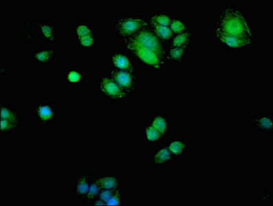 ADK / Adenosine Kinase Antibody - Immunofluorescent analysis of PC3 cells at a dilution of 1:100 and Alexa Fluor 488-congugated AffiniPure Goat Anti-Rabbit IgG(H+L)