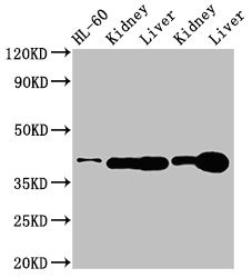 ADK / Adenosine Kinase Antibody - Positive Western Blot detected in HL-60 whole cell lysate, Rat kidney tissue, Rat liver tissue, Mouse kideny tissue, Mouse liver tissue. All lanes: ADK antibody at 3 µg/ml Secondary Goat polyclonal to rabbit IgG at 1/50000 dilution. Predicted band size: 41, 39, 35, 37 KDa. Observed band size: 41 KDa