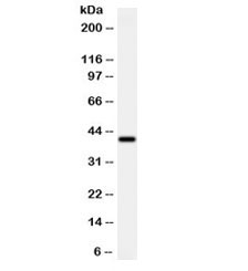 ADK / Adenosine Kinase Antibody - Western blot testing of human MCF7 cell lysate with ADK antibody at 0.5ug/ml. Predicted molecular weight ~40 kDa.