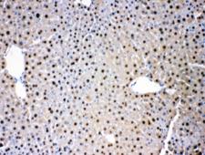 ADK / Adenosine Kinase Antibody - IHC testing of FFPE mouse liver with ADK antibody at 1ug/ml. HIER: steam sections in pH6 citrate buffer for 20 min.