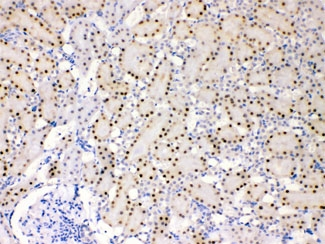 ADK / Adenosine Kinase Antibody - IHC testing of FFPE rat kidney with ADK antibody at 1ug/ml. HIER: steam sections in pH6 citrate buffer for 20 min.