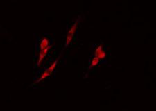 ADK / Adenosine Kinase Antibody - Staining RAW264.7 cells by IF/ICC. The samples were fixed with PFA and permeabilized in 0.1% Triton X-100, then blocked in 10% serum for 45 min at 25°C. The primary antibody was diluted at 1:200 and incubated with the sample for 1 hour at 37°C. An Alexa Fluor 594 conjugated goat anti-rabbit IgG (H+L) antibody, diluted at 1/600, was used as secondary antibody.