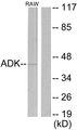 ADK / Adenosine Kinase Antibody - Western blot analysis of extracts from RAW264.7 cells, using ADK antibody.
