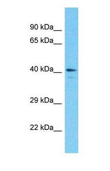 ADK / Adenosine Kinase Antibody - Western blot of ADK Antibody with Placenta lysate.  This image was taken for the unconjugated form of this product. Other forms have not been tested.