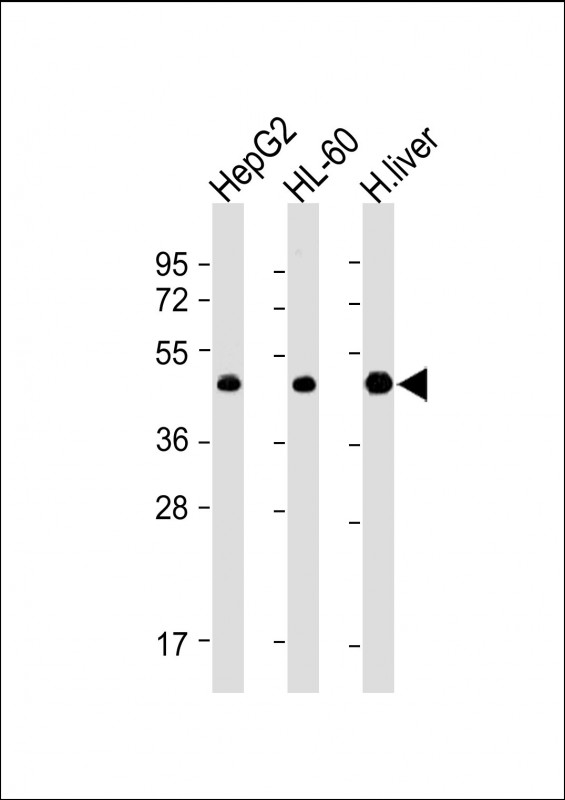 ADK / Adenosine Kinase Antibody - All lanes: Anti-ADK Antibody (N-term) at 1:4000 dilution Lane 1: HepG2 whole cell lysate Lane 2: HL-60 whole cell lysate Lane 3: Human liver lysate Lysates/proteins at 20 µg per lane. Secondary Goat Anti-mouse IgG, (H+L), Peroxidase conjugated at 1/10000 dilution. Predicted band size: 45 kDa Blocking/Dilution buffer: 5% NFDM/TBST.