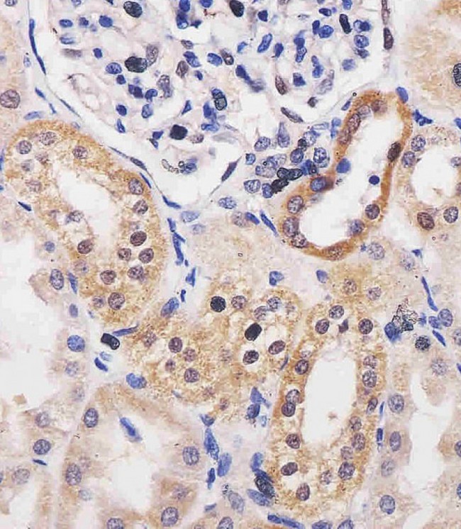 ADK / Adenosine Kinase Antibody - ADK Antibody (N-term) staining ADK in human kidney tissue sections by Immunohistochemistry (IHC-P - paraformaldehyde-fixed, paraffin-embedded sections). Tissue was fixed with formaldehyde and blocked with 3% BSA for 0. 5 hour at room temperature; antigen retrieval was by heat mediation with a citrate buffer (pH6). Samples were incubated with primary antibody (1/25) for 1 hours at 37°C. A undiluted biotinylated goat polyvalent antibody was used as the secondary antibody.