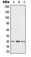 ADK / Adenosine Kinase Antibody - Western blot analysis of Adenosine Kinase expression in HepG2 (A); NIH3T3 (B); PC12 (C) whole cell lysates.
