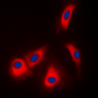 ADK / Adenosine Kinase Antibody - Immunofluorescent analysis of Adenosine Kinase staining in HepG2 cells. Formalin-fixed cells were permeabilized with 0.1% Triton X-100 in TBS for 5-10 minutes and blocked with 3% BSA-PBS for 30 minutes at room temperature. Cells were probed with the primary antibody in 3% BSA-PBS and incubated overnight at 4 C in a humidified chamber. Cells were washed with PBST and incubated with a DyLight 594-conjugated secondary antibody (red) in PBS at room temperature in the dark. DAPI was used to stain the cell nuclei (blue).