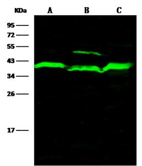 ADK / Adenosine Kinase Antibody - Anti-ADK rabbit polyclonal antibody at 1:500 dilution. Lane A: RAW264.7 Whole Cell Lysate. Lane B: 293T Whole Cell Lysate. Lane C: NIH/3T3 Whole Cell Lysate. Lane D: Hela Whole Cell Lysate. Lysates/proteins at 30 ug per lane. Secondary: Goat Anti-Rabbit IgG H&L (Dylight800) at 1/10000 dilution. Developed using the Odyssey technique. Performed under reducing conditions. Predicted band size: 40 kDa. Observed band size: 40 kDa. (We are unsure as to the identity of these extra bands.)