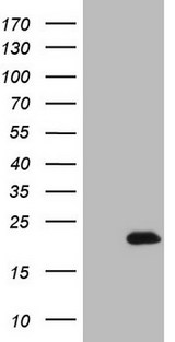ADM / Adrenomedullin Antibody - HEK293T cells were transfected with the pCMV6-ENTRY control (Left lane) or pCMV6-ENTRY ADM (Right lane) cDNA for 48 hrs and lysed. Equivalent amounts of cell lysates (5 ug per lane) were separated by SDS-PAGE and immunoblotted with anti-ADM.