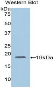 ADM / Adrenomedullin Antibody - Western blot of recombinant ADM / Adrenomedullin.  This image was taken for the unconjugated form of this product. Other forms have not been tested.