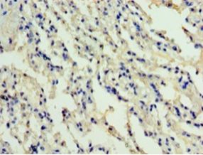 ADM / Adrenomedullin Antibody - Immunohistochemistry of paraffin-embedded human lung tissue using antibody at 1:100 dilution.  This image was taken for the unconjugated form of this product. Other forms have not been tested.