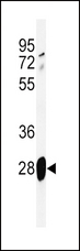 ADM / Adrenomedullin Antibody - Western blot of ADM Antibody in mouse lung tissue lysates (35 ug/lane). ADM (arrow) was detected using the purified antibody.