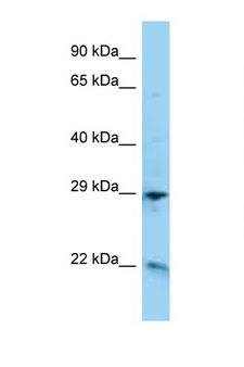 ADM / Adrenomedullin Antibody - ADM / Adrenomedullin antibody Western blot of HepG2 Cell lysate. Antibody concentration 1 ug/ml.  This image was taken for the unconjugated form of this product. Other forms have not been tested.