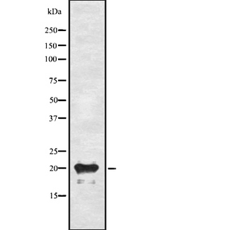 ADM / Adrenomedullin Antibody - Western blot analysis of ADM using A549 whole cells lysates